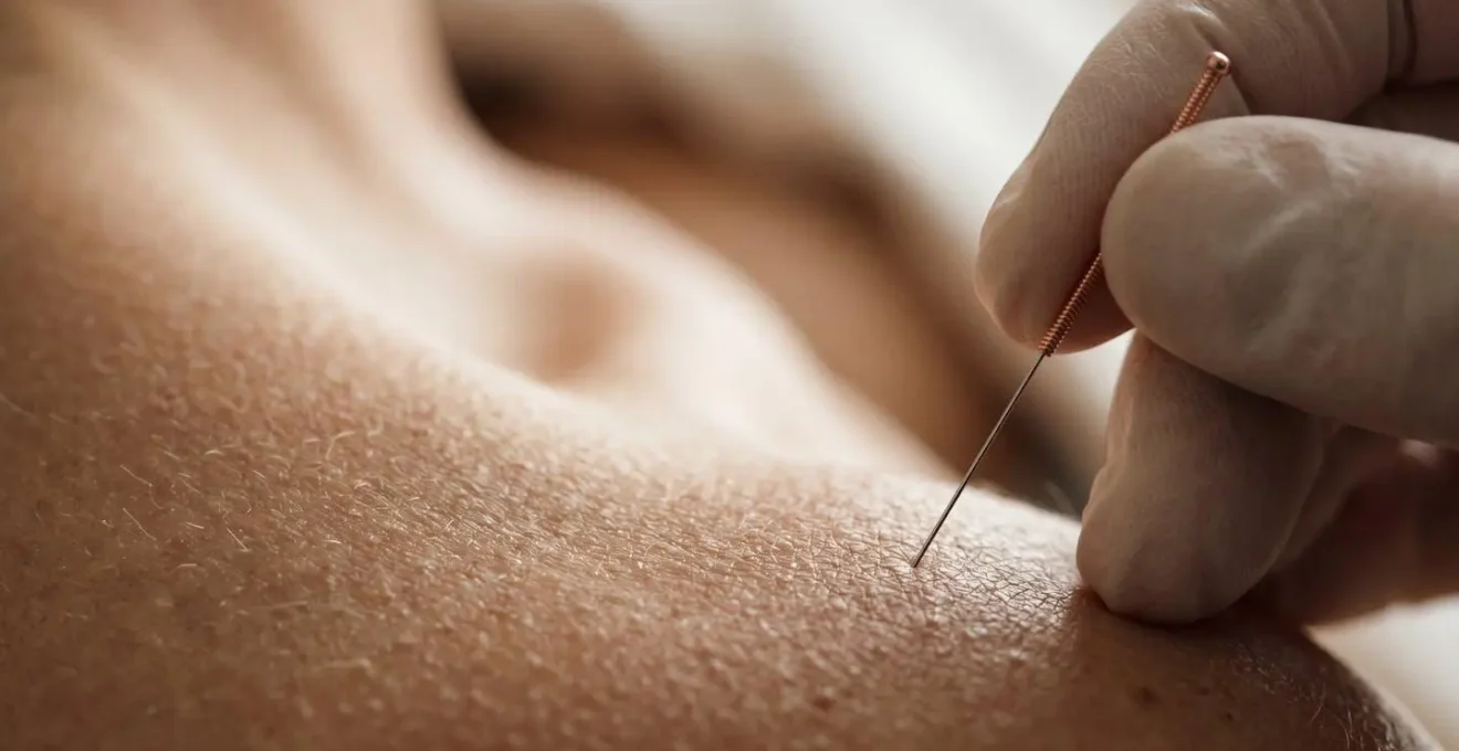 Macro textural view of muscle tissue with subtle anatomical detail showing the precision targeting approach of modern dry needling therapy
